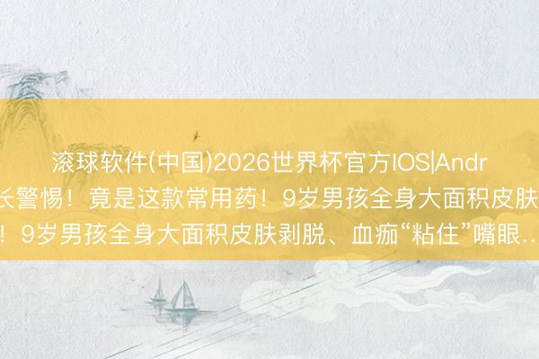 滚球软件(中国)2026世界杯官方IOS|Android手机app下载 上海家长警惕！竟是这款常用药！9岁男孩全身大面积皮肤剥脱、血痂“粘住”嘴眼…